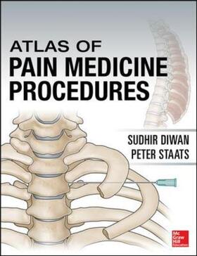 Atlas of Pain Medicine Procedures