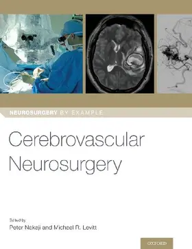 Cerebrovascular Neurosurgery