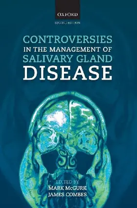 Controversies in the Management of Salivary Gland Disease