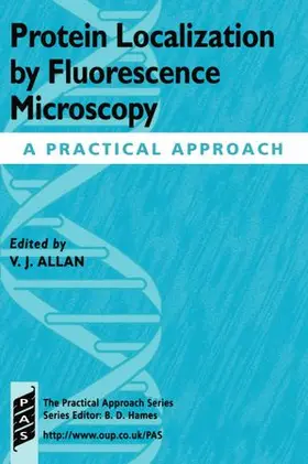 Protein Localization by Fluorescence Microscopy: A Practical Approach