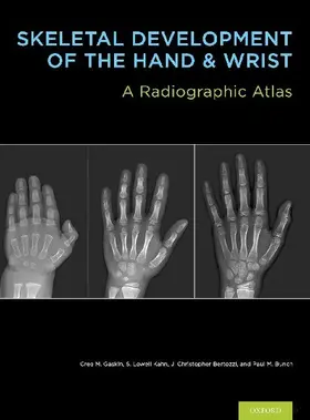 SKEL DEVELOP HAND & WRIST BK & DVD PCK