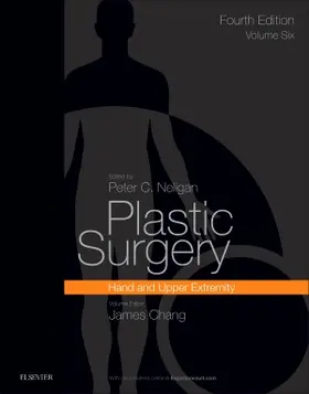 Plastic Surgery: Volume 6: Hand and Upper Limb