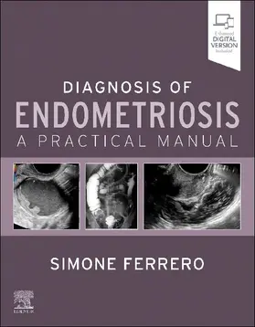 Diagnosis of Endometriosis