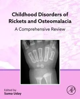 Childhood Disorders of Rickets and Osteomalacia