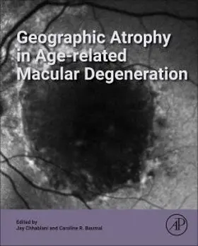 Geographic Atrophy in Age-Related Macular Degeneration