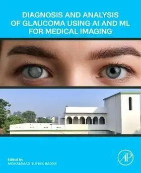 Diagnosis and Analysis of Glaucoma Using AI and ML for Medical Imaging