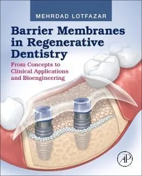 Barrier Membranes in Regenerative Dentistry