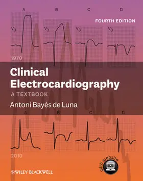 Clinical Electrocardiography: A Textbook