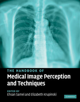 The Handbook of Medical Image Perception and Techniques