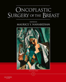 Oncoplastic Surgery of the Breast with DVD [With DVD ROM]