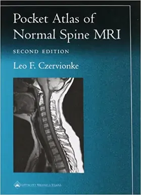 Pocket Atlas of Spinal MRI