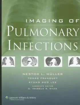 Imaging of Pulmonary Infections