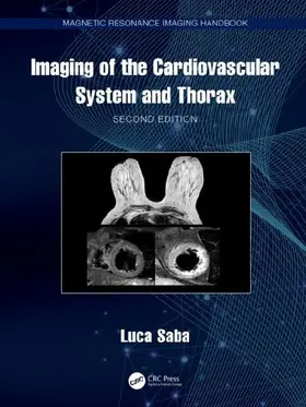 Imaging of the Cardiovascular System and Thorax