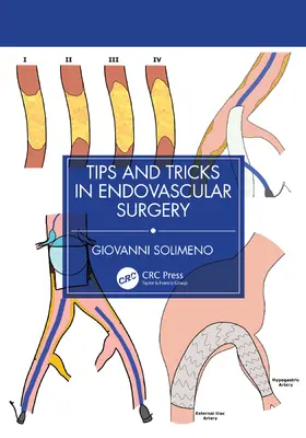 Tips and Tricks in Endovascular Surgery