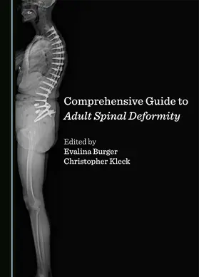 Comprehensive Guide to Adult Spinal Deformity