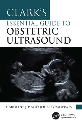 Clark's Essential Guide to Obstetric Ultrasound