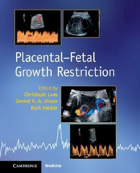 Placental-Fetal Growth Restriction
