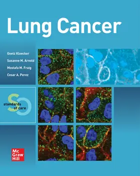 Lung Cancer