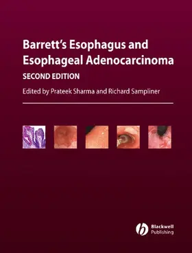 Barrett&#8242;s Esophagus and Esophageal Adenocarcinoma