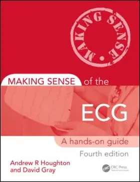 Making Sense of the ECG