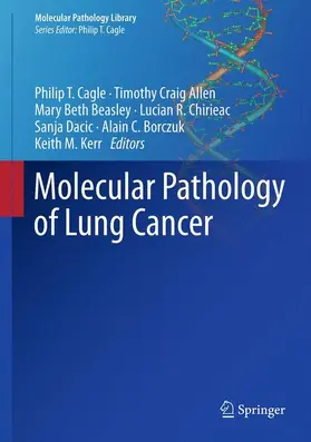 Molecular Pathology of Lung Cancer