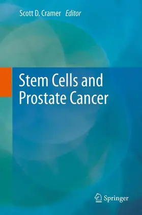Stem Cells and Prostate Cancer