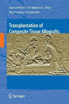 Transplantation of Composite Tissue Allografts