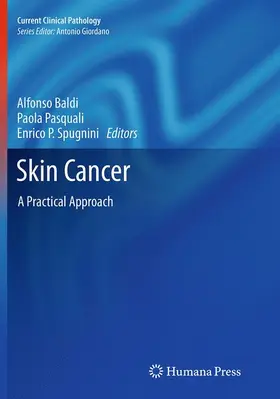 Skin Cancer