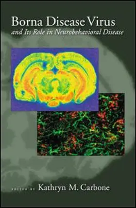 Borna Disease Virus and Its Role in Neurobehavioral Diseases