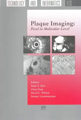 Plaque Imaging