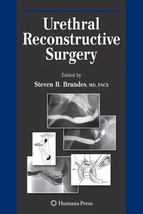 Urethral Reconstructive Surgery