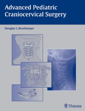Advanced Pediatric Craniocervical Surgery