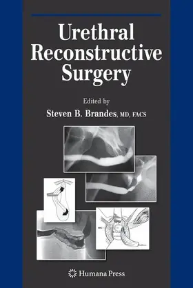 Urethral Reconstructive Surgery