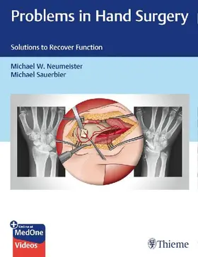 Problems in Hand Surgery