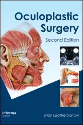 Oculoplastic Surgery