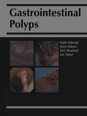 Gastrointestinal Polyps