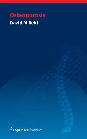 Handbook of Osteoporosis