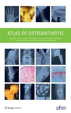 Atlas of Osteoarthritis