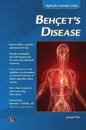 Behcet's Disease