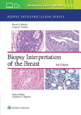 Biopsy Interpretation of the Breast: Print + eBook with Multimedia