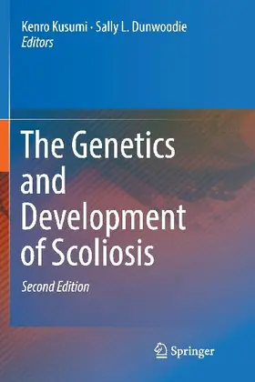The Genetics and Development of Scoliosis