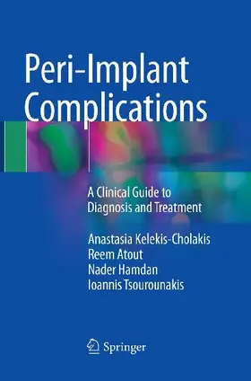 Peri-Implant Complications