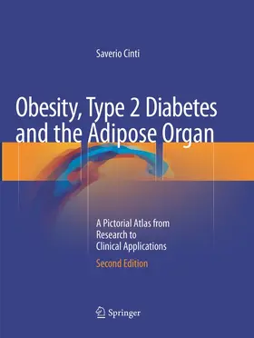 Obesity, Type 2 Diabetes and the Adipose Organ