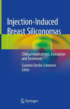 Injection-Induced Breast Siliconomas