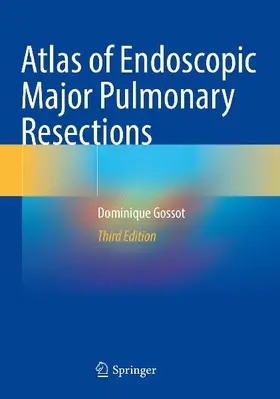 Atlas of Endoscopic Major Pulmonary Resections