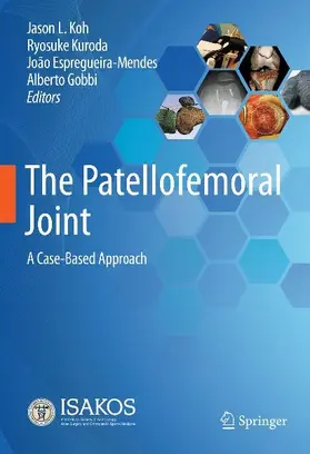 The Patellofemoral Joint