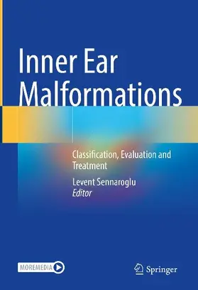 Inner Ear Malformations