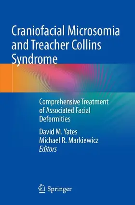 Craniofacial Microsomia and Treacher Collins Syndrome