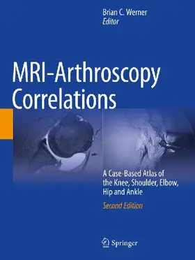 MRI-Arthroscopy Correlations