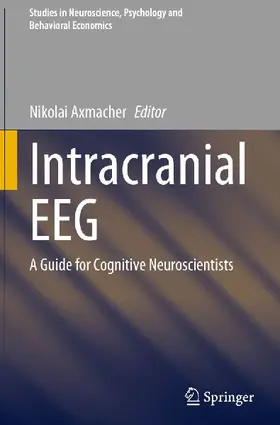 Intracranial EEG